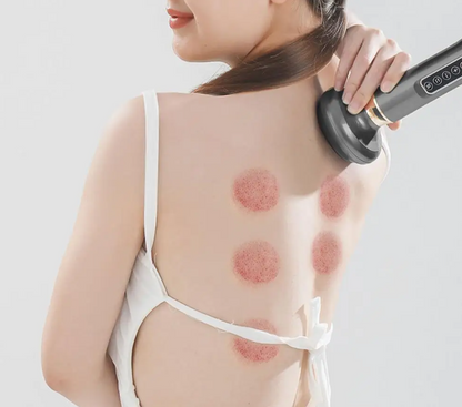 Handheld Anti-Cellulite Massager | Suction & Hot Compress